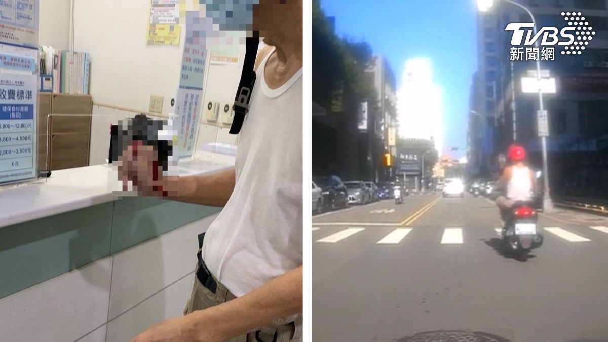 台中裝潢工「切斷大拇哥」炸血 巡邏警開道搶黃金時間