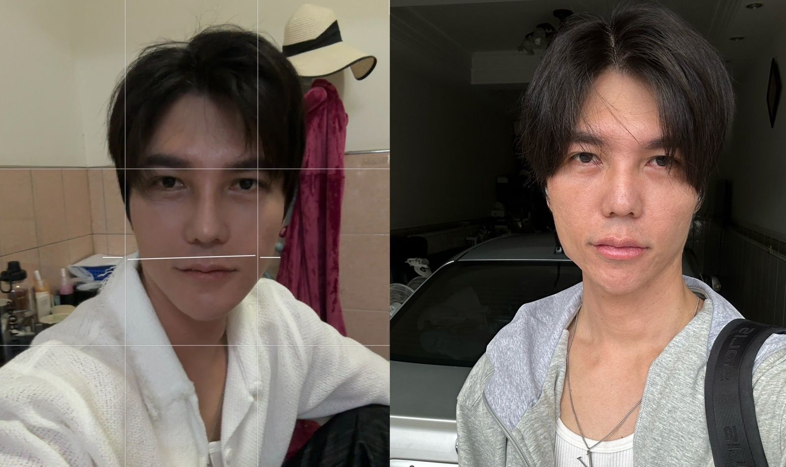 「口罩男」做了隆鼻、下巴整形、墊法令紋及豐額頭手術，整個人狀態極佳。（圖／口罩男提供）