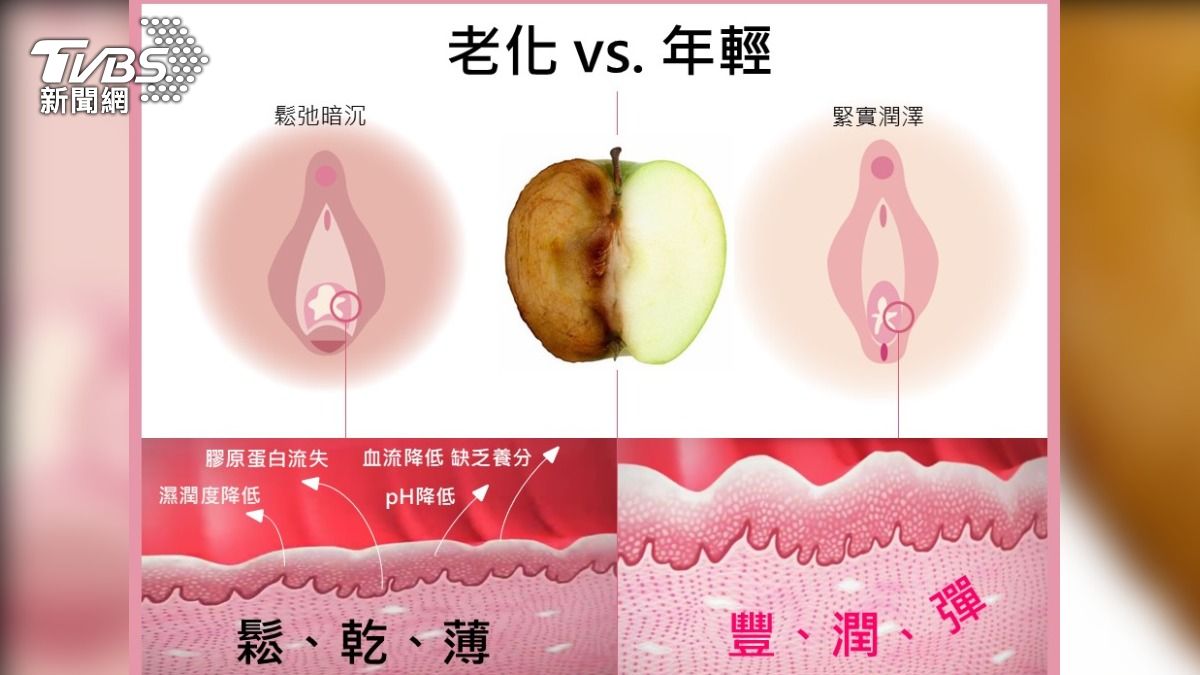 陰道雷射使鬆、乾、薄的陰道內壁,轉變為豐、潤、彈。(圖/Lutronic)