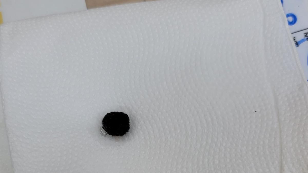 小四男童「巨大鼻屎」挖不出來!醫愣:沒再追問 爸爸臉黑了
