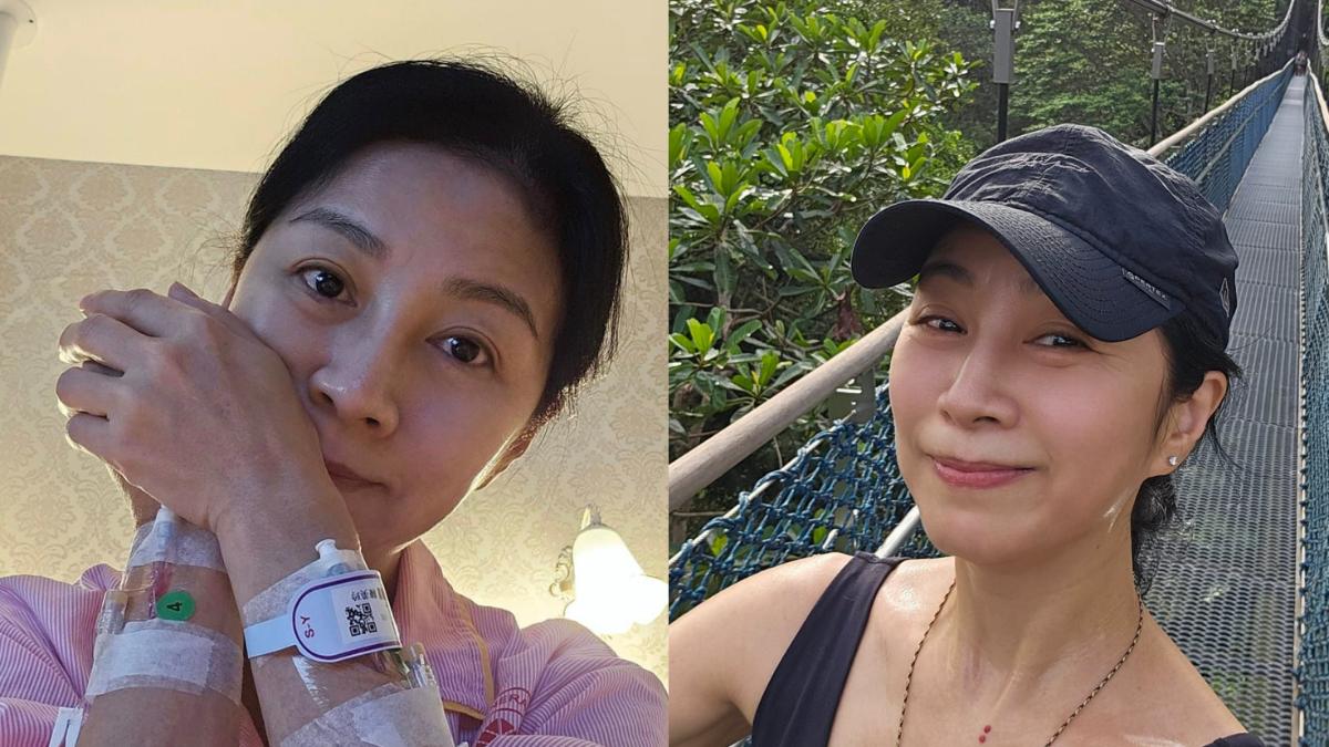 方文琳大意了!「3年沒做健檢」忽略紅字警告 一查竟驗出食道癌