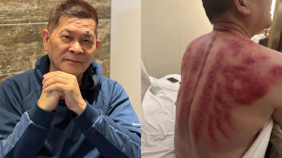 澎恰恰拍陸劇還債!汗水浸濕戲服 「背部一片紅」嘆:還好撐住了