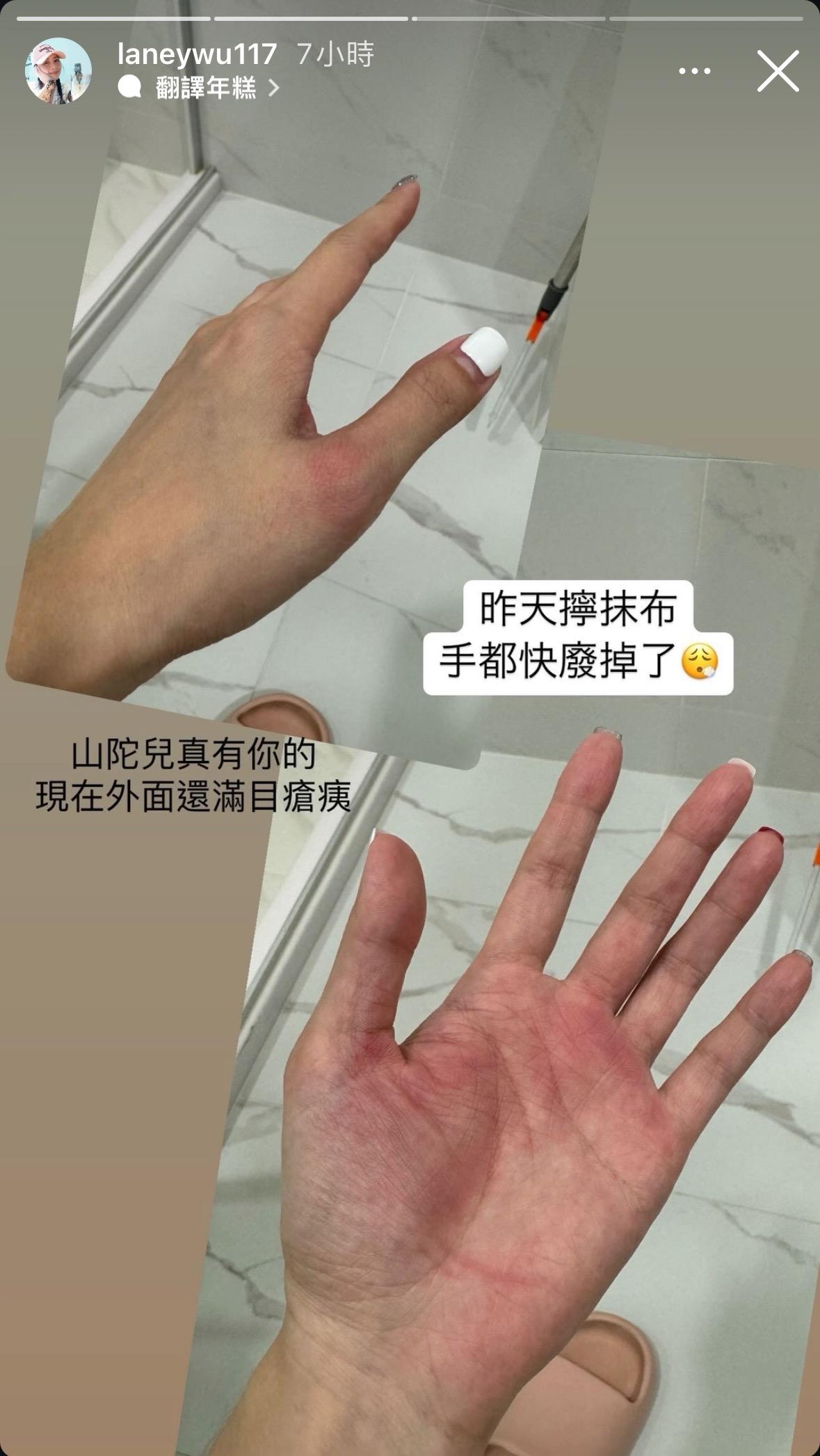 吳淑敏雙手因擰抹布發紅。（圖／翻攝自IG）