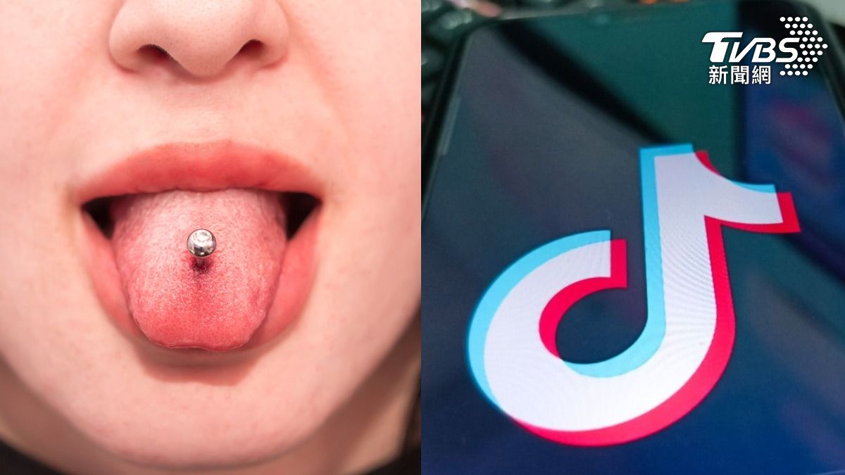 又是TikTok!5童進行「舌環挑戰」誤吞磁鐵 恐致腸胃穿孔
