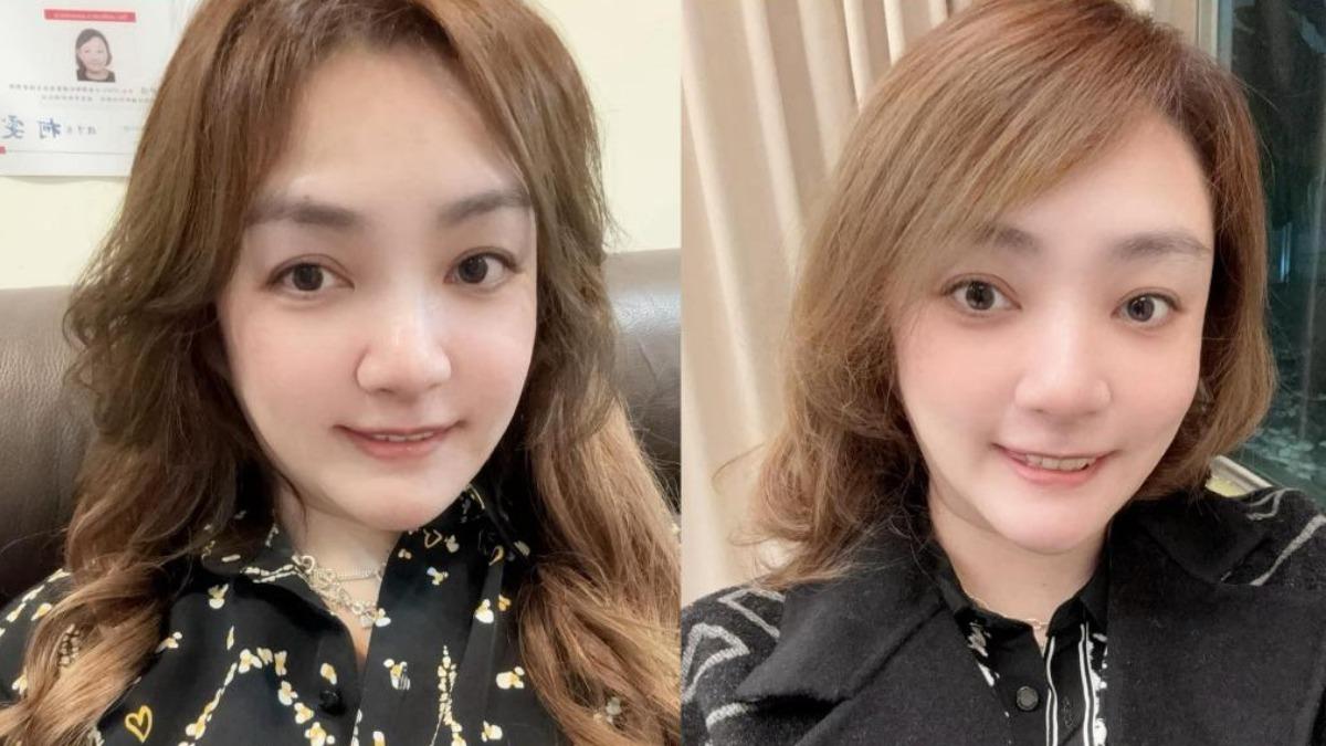 女星爆罹「不治之症」恐截肢!血糖飆1266 醫:糖尿病可以治
