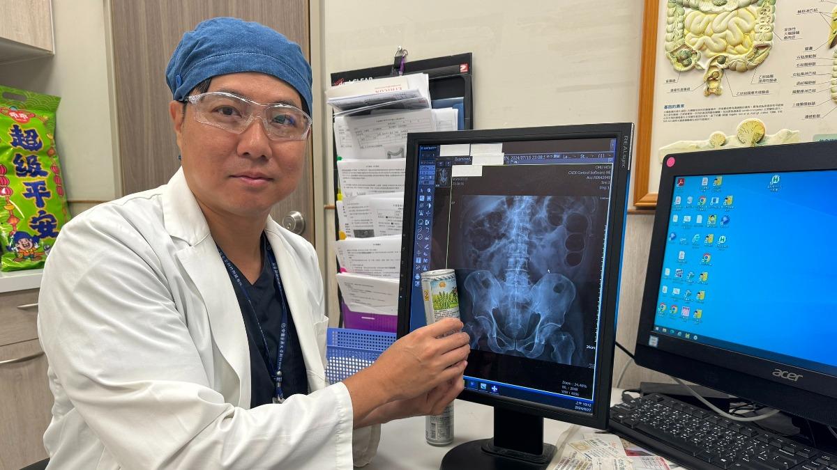 中年男便秘3天!一照X光「肛門竟塞易開罐」 醫曝下場