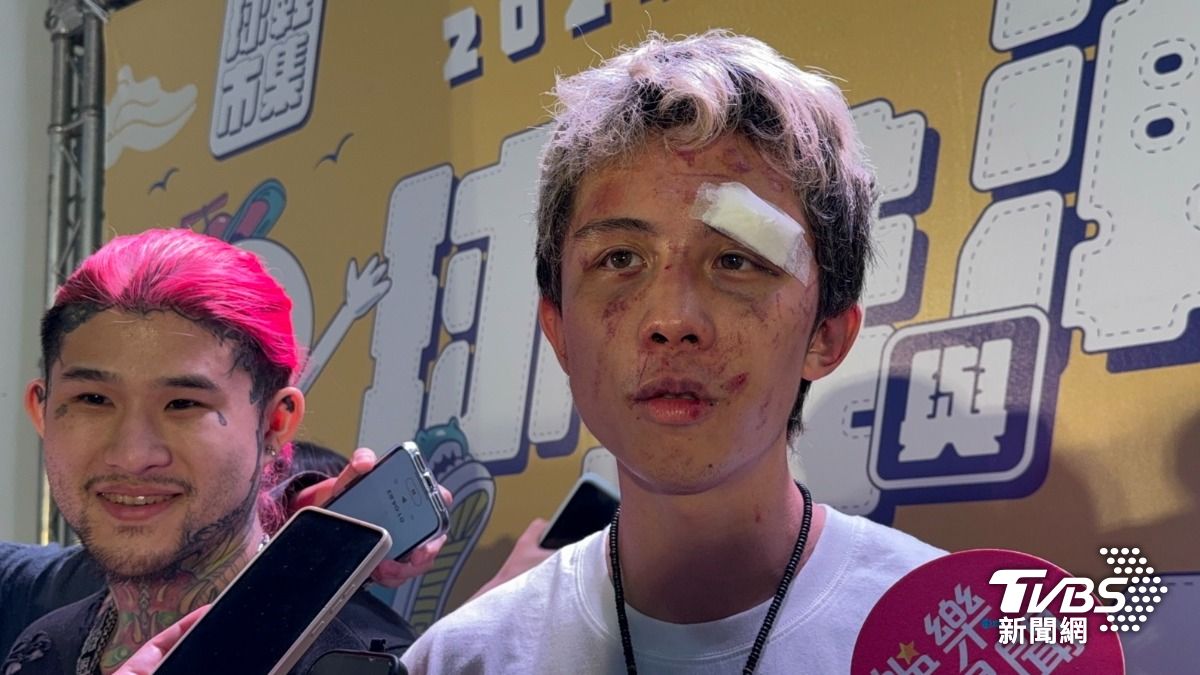 孫安佐遭暴打「全臉毀容」!傳開刀拆肋骨 經紀人回應了