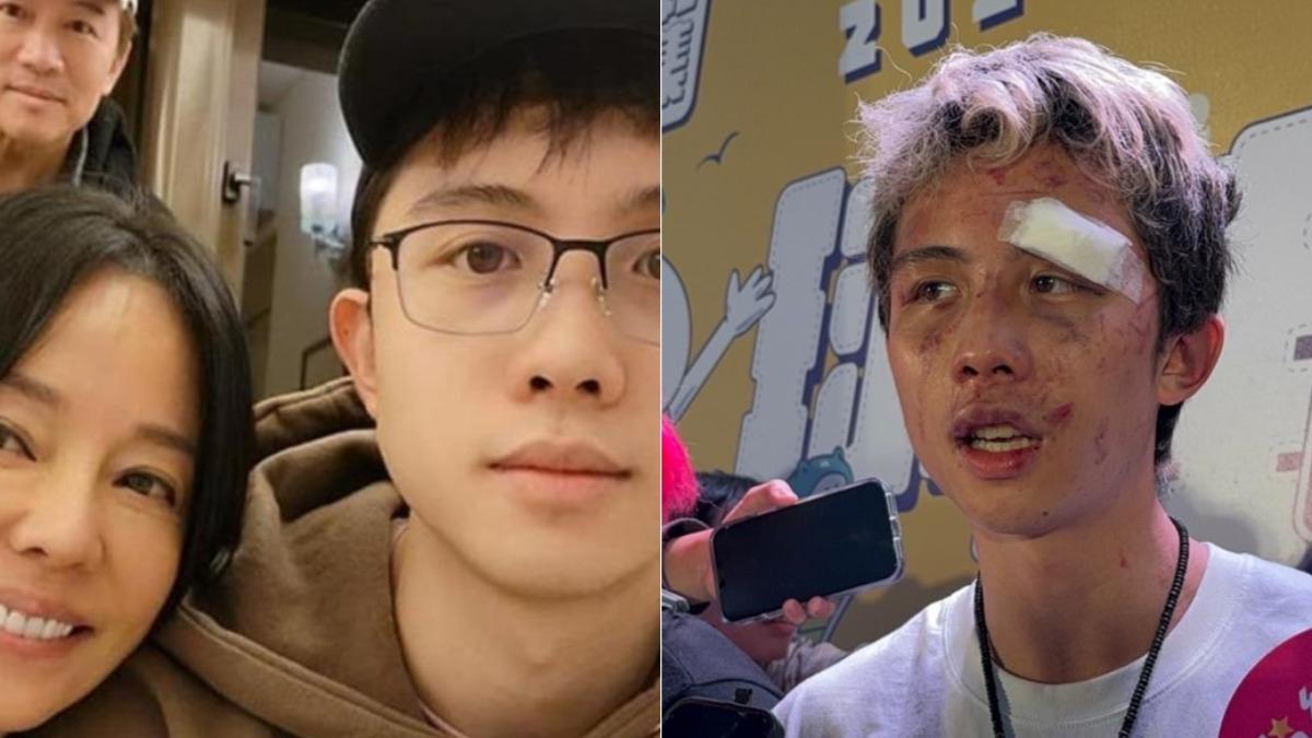 孫安佐遭打爆「滿臉血」縫2針!被問韓森 狄鶯不忍了首發聲