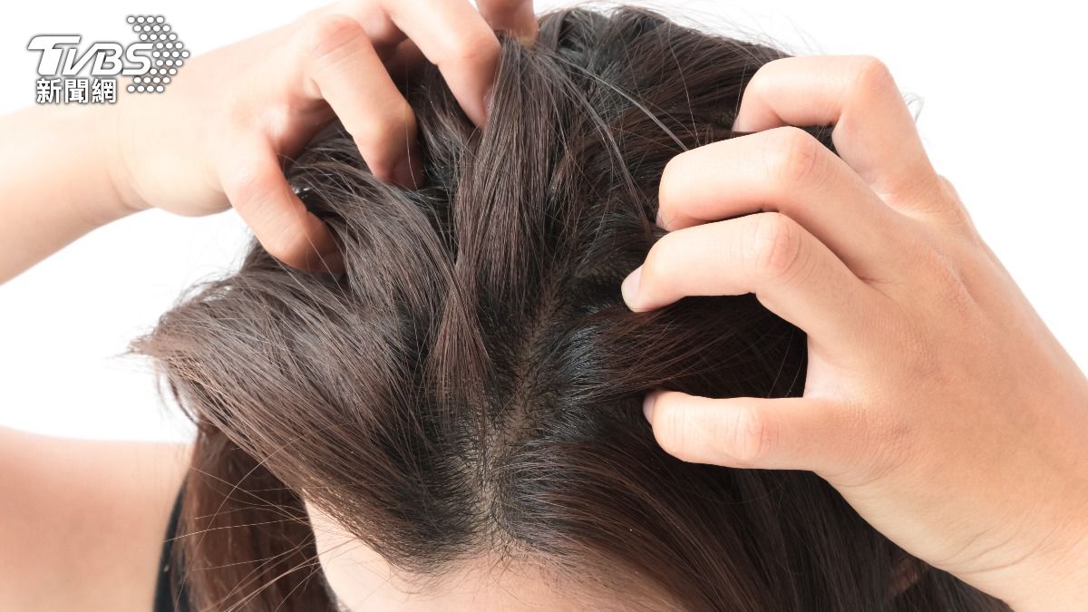 換季頭皮癢又油！4種「頭癢原因」大揭密　正確洗頭法一次看