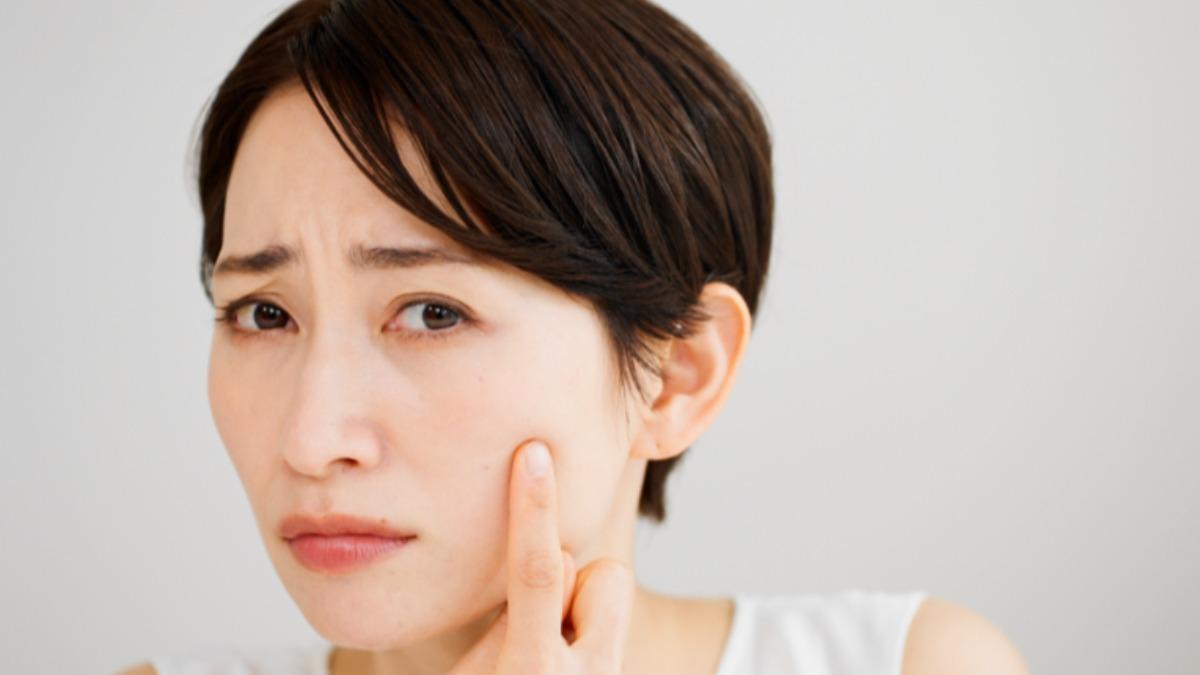 解決乾燥蠟黃。(示意圖/shutterstock達志影像)
