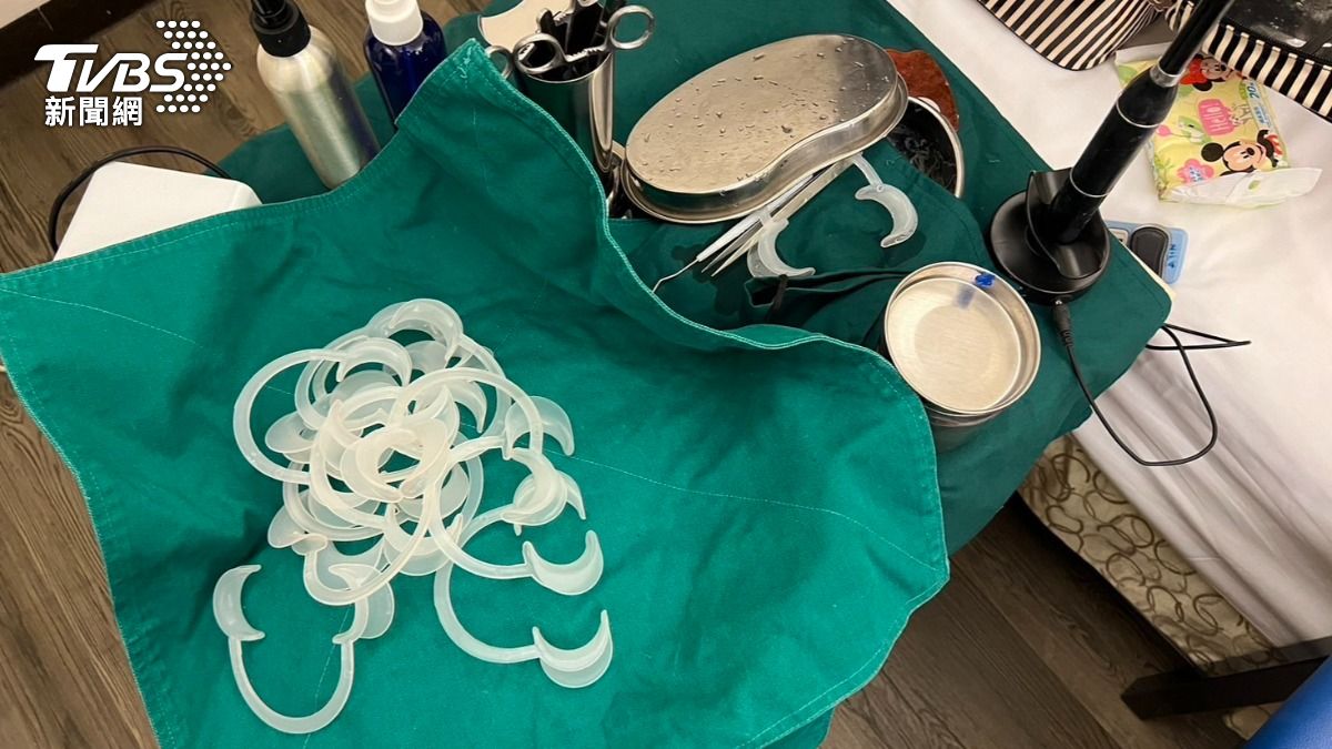 俗又大碗?越南女「邊做邊學」地下醫美 同鄉預約搶破頭