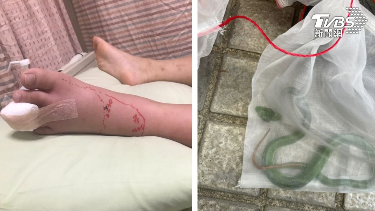 高雄男童腳被咬成麵龜！大樓住戶「掃把+畚箕」抓到赤尾青竹絲