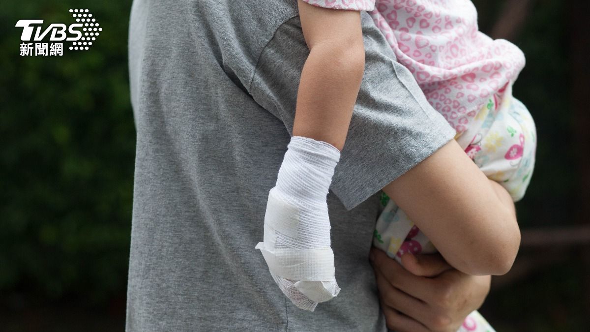 陸6歲童遭潑熱水毀容!校方緩頰「只是貪玩」:沒注意到水溫