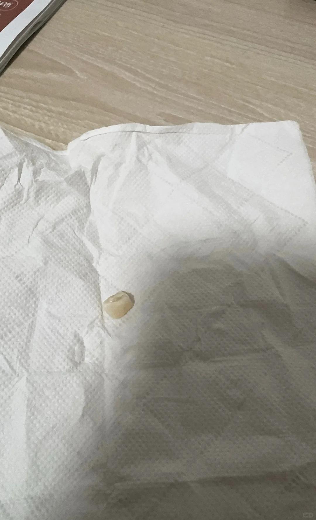 男子手機砸臉，門牙被砸斷。（圖／翻攝自小紅書）