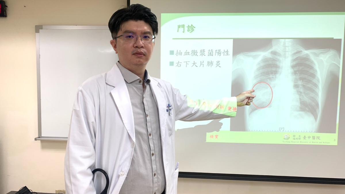 赴日探親低燒乾咳!女大生惡化右肺白一片 竟中「行走的肺炎」