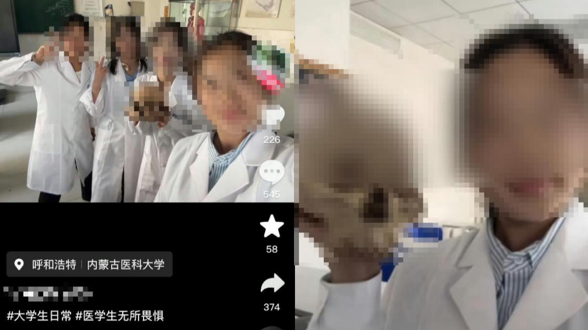 捧「大體老師頭骨」合照!陸醫學生比YA燦笑 嗨喊:無所畏懼
