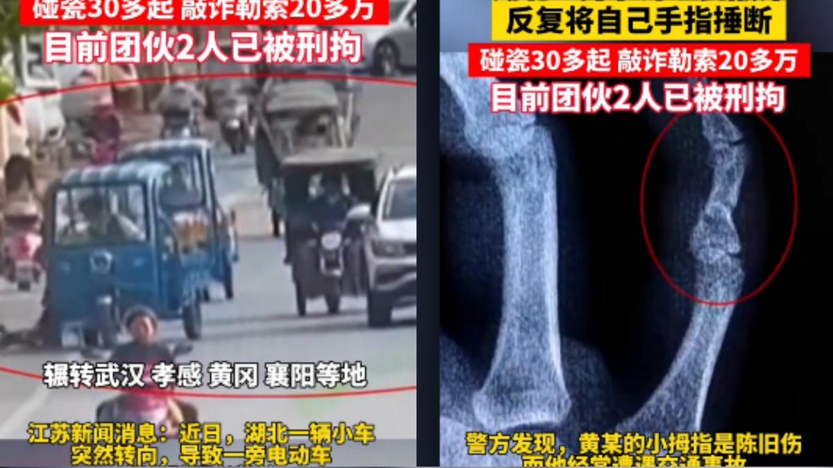 詐騙專業戶!男子「捶斷手指」假車禍30餘起敲詐90萬