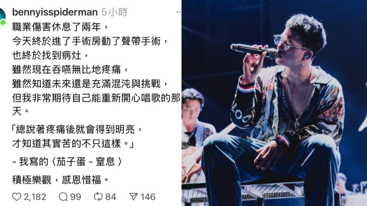 茄子蛋主唱阿斌花了2年終於找到病因，也終於動了聲帶手術。（圖／翻攝自阿斌Threads、茄子蛋臉書）