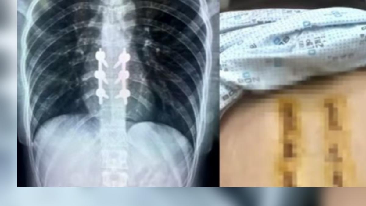 和朋友打賭！把女友丟海裡害脊椎骨折　韓男辯：她喝醉記錯了