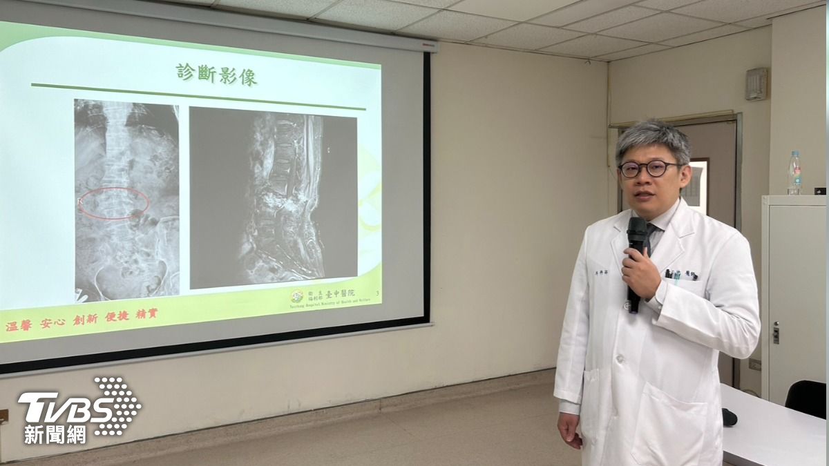台中婦痛到走不了!一查乳癌末期急切胸 醫曝:最年輕僅22歲