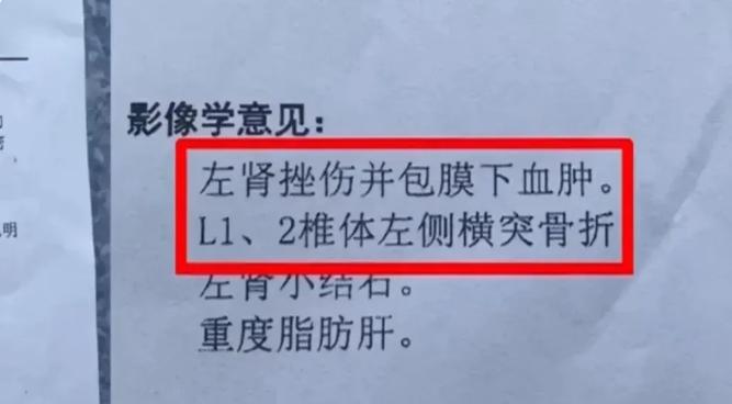 劉男被大王椰子樹葉砸到骨折、挫傷。(圖/翻攝自微博)