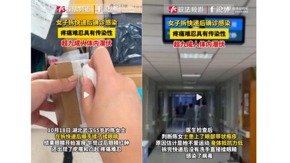女子開完包裹後竟意外感染帶狀疱疹。(圖/翻攝自 長沙政法頻道微博)