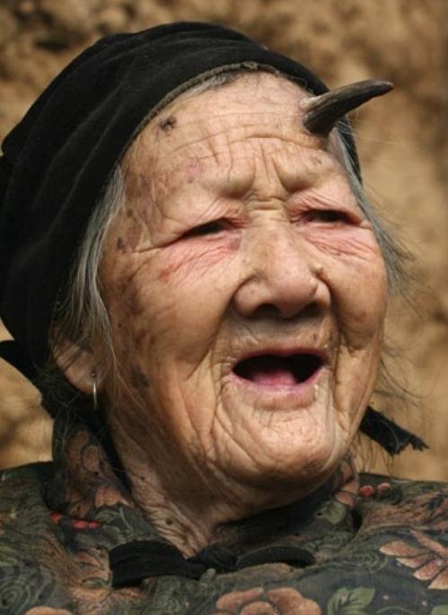 老人頭上長角的事件已非首例。（圖／翻攝自微博）