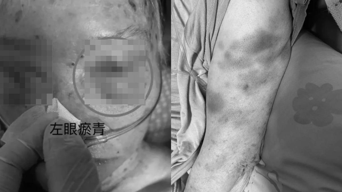 上班4個月「性情大變」！苗栗移工揍嬤　認了：心情煩出氣