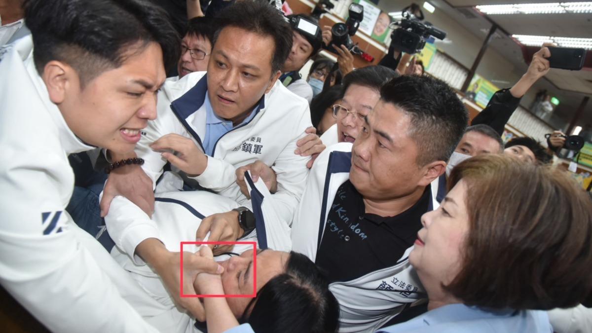 陳玉珍「遭拔牙」畫面曝! 徐巧芯公佈照片:誰說沒碰到嘴巴