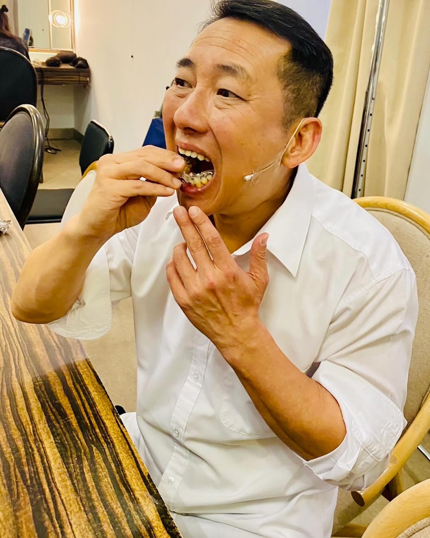 屈中恆8月時曾透露,使用隱形透明的方式矯正他的牙齒。(圖/翻攝自「屈中恆藝嚮世界」臉書)