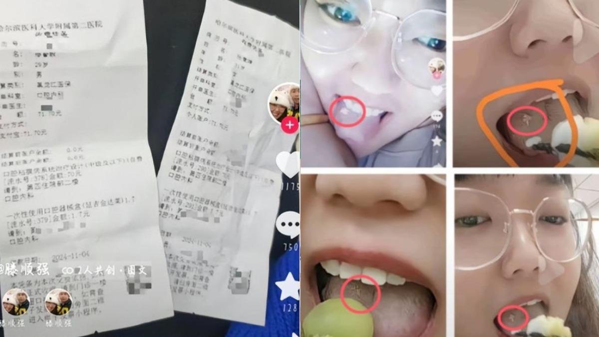 兩人到醫院做檢查,還是沒人要信。(圖/翻攝自網易)