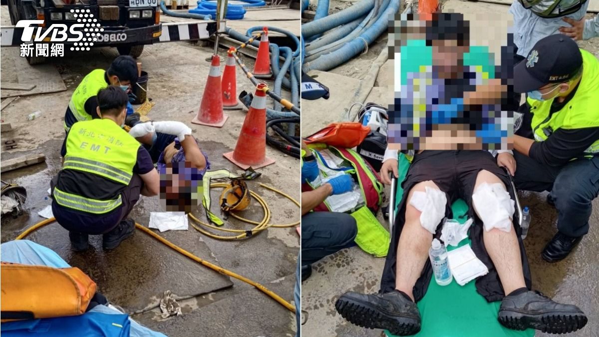 蘆洲捷運上周才挖斷電纜爆炸!2台電員工搶修 遭電擊「手臂焦黑」