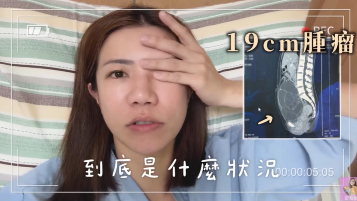 江老師拍攝切除腫瘤術前術後的狀況。(圖/翻攝自我是江老師YT頻道)