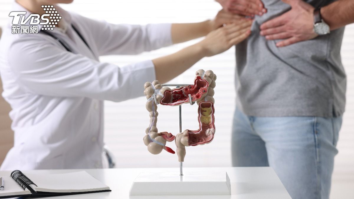 別過度消毒!大腸癌「年輕化兇手」藏腸道攻擊 4習慣養出腫瘤