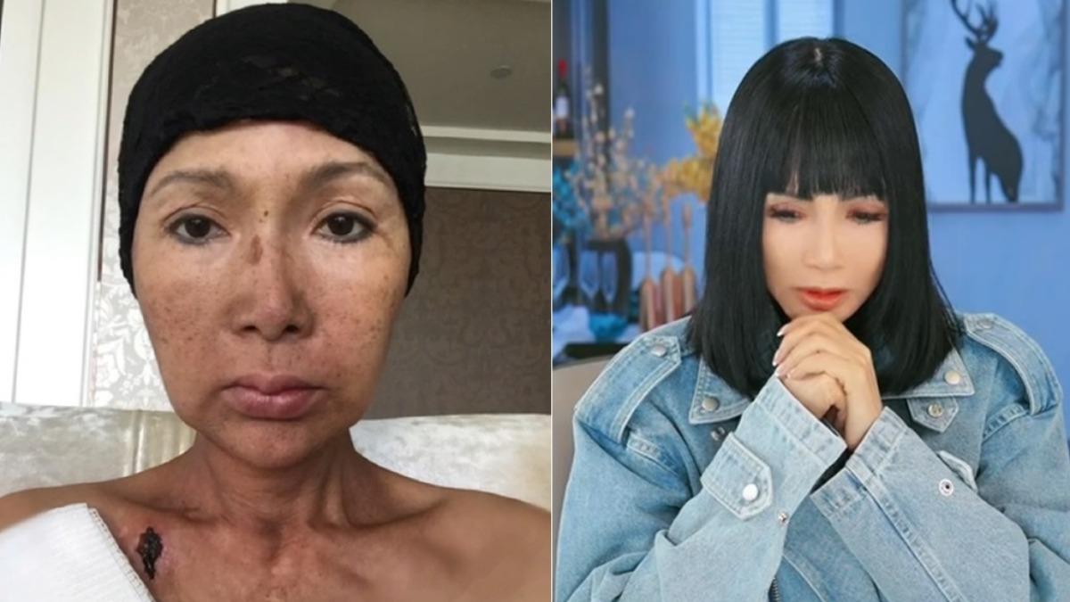 陸女星得雙癌!「又罹舌癌」切半個舌頭 崩潰宣布暫別:不能唱歌了
