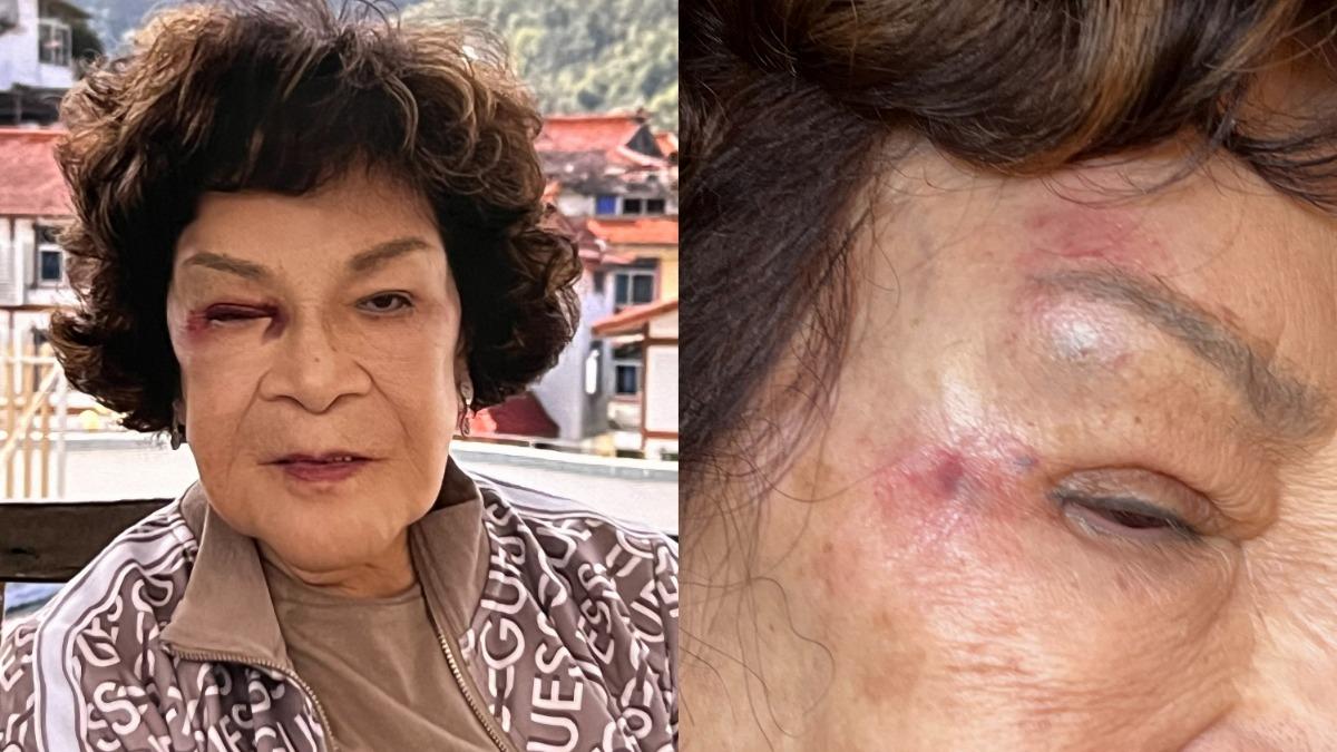 87歲周遊才摔傷濺血爆哭！無預警住院「開刀10小時」　新病況曝