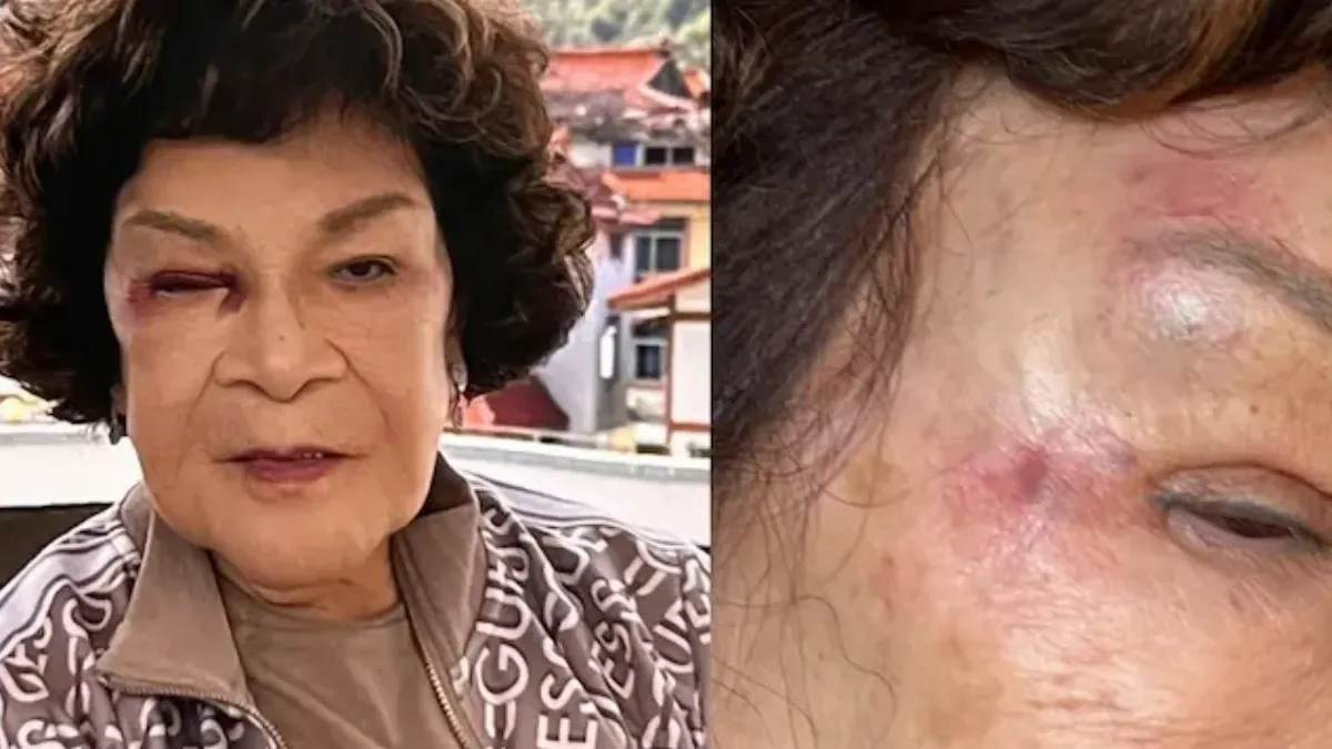 87歲影視名人「跌一跤」出事了!廁所摔傷頭 老人養傷這樣做