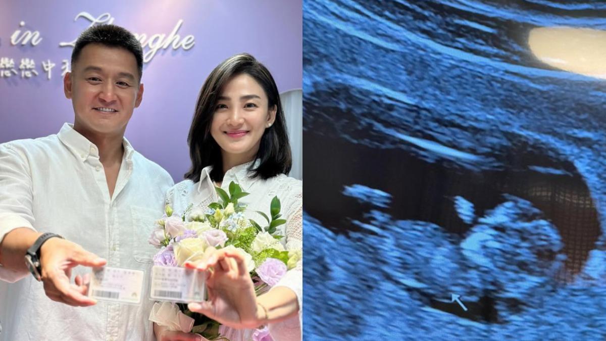 46歲洪小鈴突宣布懷孕！嫁20年好友張天霖　公開「寶寶性別」