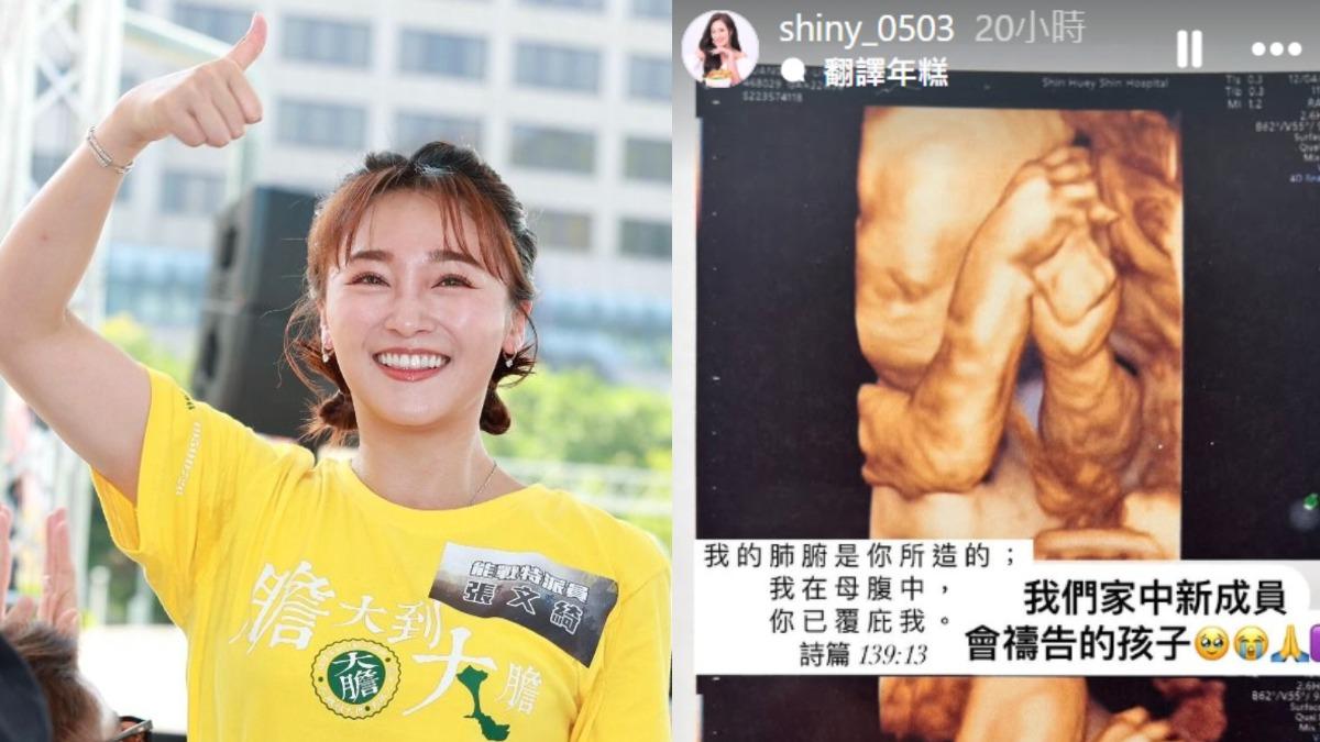 才恢單1年!33歲張文綺無預警拋「超音波照」 喜曝:會禱告的孩子