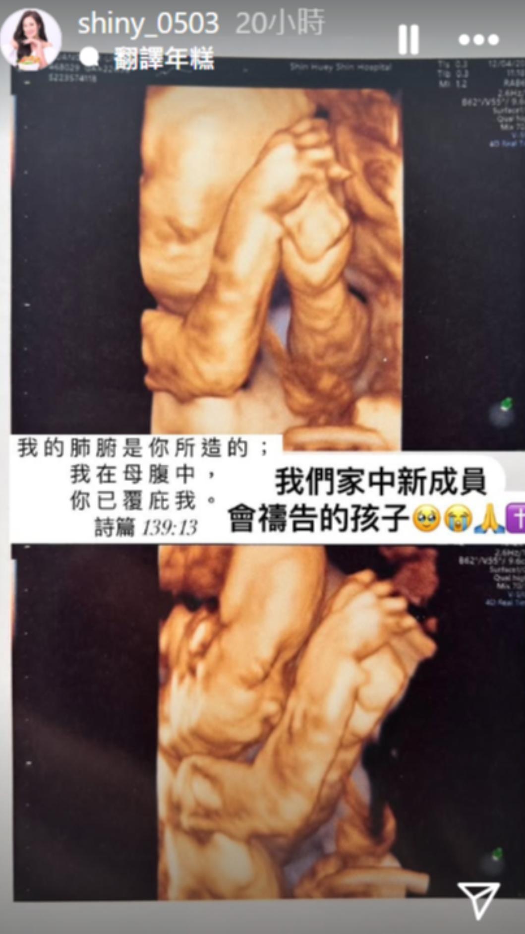 胎兒模樣像極在禱告，身為基督徒的張文綺相當感動。（圖／翻攝自張文綺IG）
