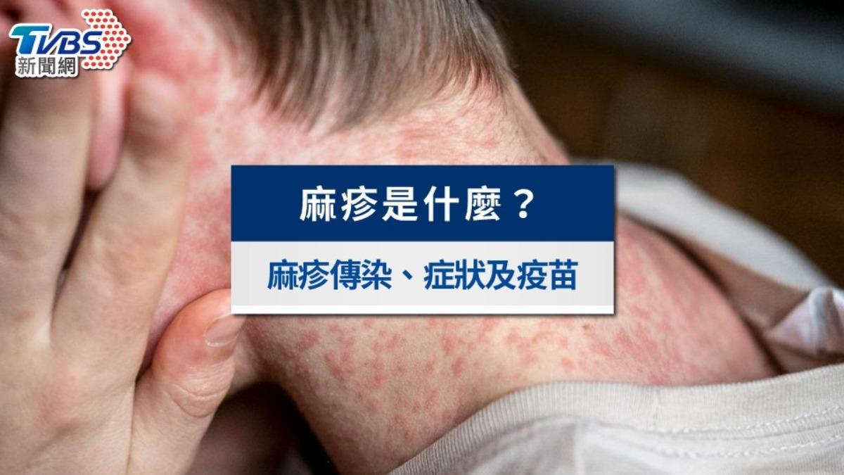 麻疹懶人包》麻疹疫苗多久打?麻疹症狀、傳染途徑和本土足跡