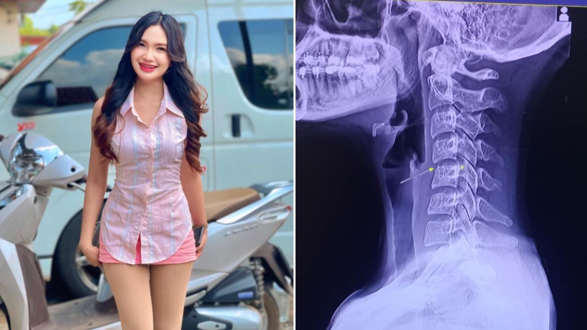 泰女歌手按摩「扭轉頸部」　慘半身癱瘓躺1個月病逝