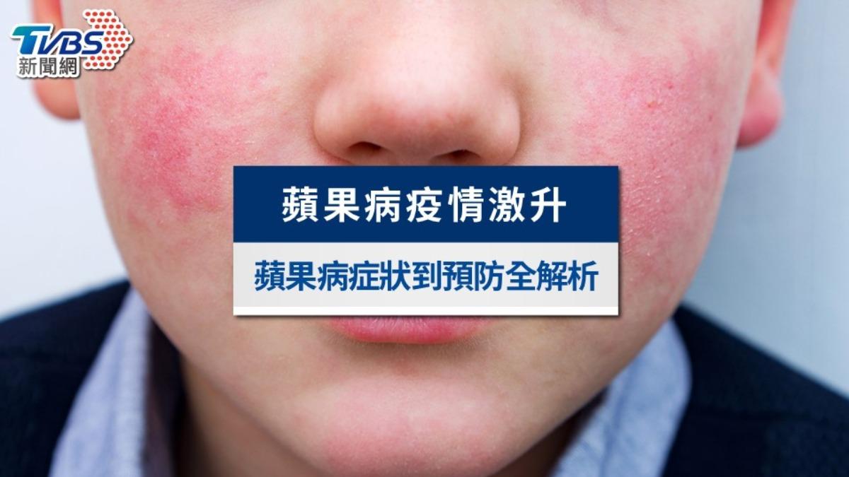 11歲女童疑染B19病毒亡!蘋果病症狀、傳染與潛伏期,大人4族群也要防