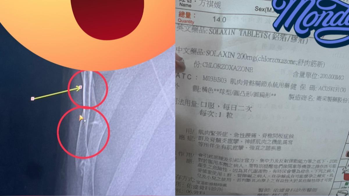 雪碧去看醫生後，雖然不用開刀，但醫生要求2、3周不能運動。（圖／翻攝自臉書）