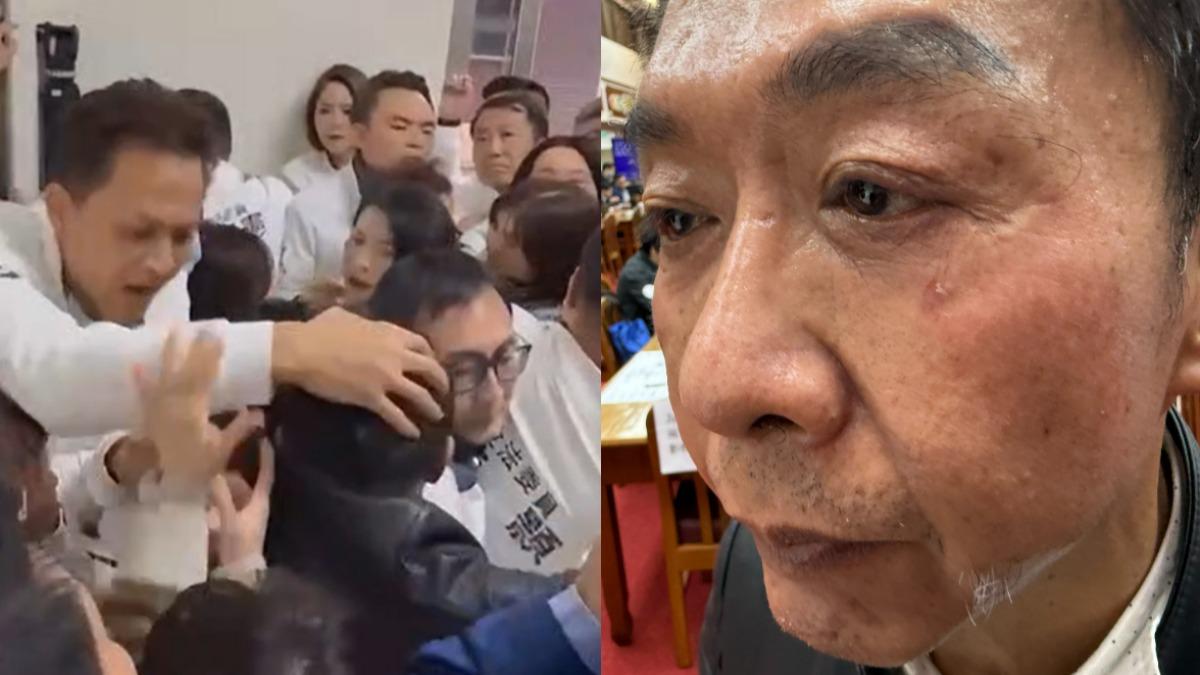 《選罷法》朝野肉搏戰!綠委控遭「打臉」掛彩 傷勢曝光