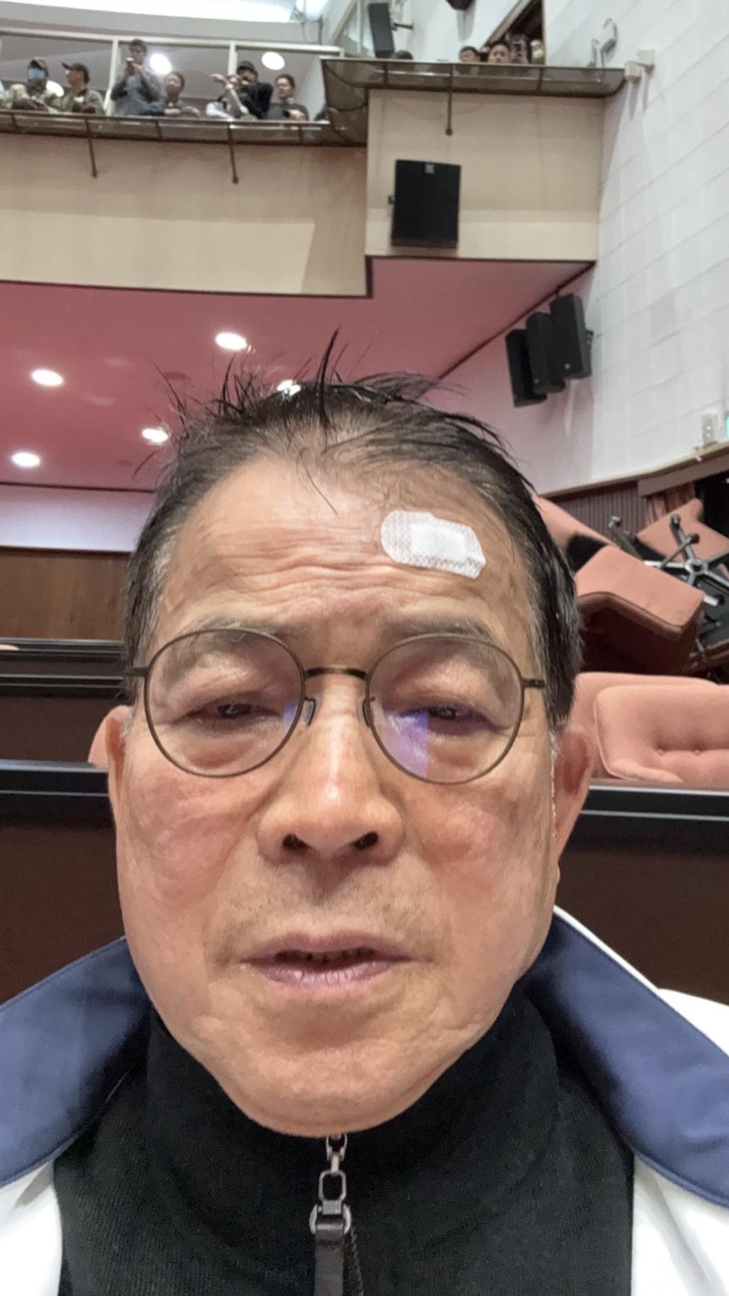 賴士葆的頭在衝突中受傷。（圖／翻攝自賴士葆臉書）