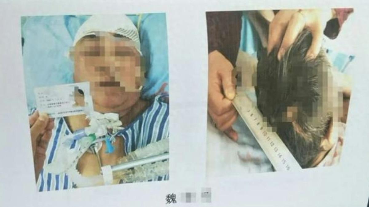 目睹母車禍重傷！陸女狂念「救媽媽」5天後身亡　醫證實：被嚇死