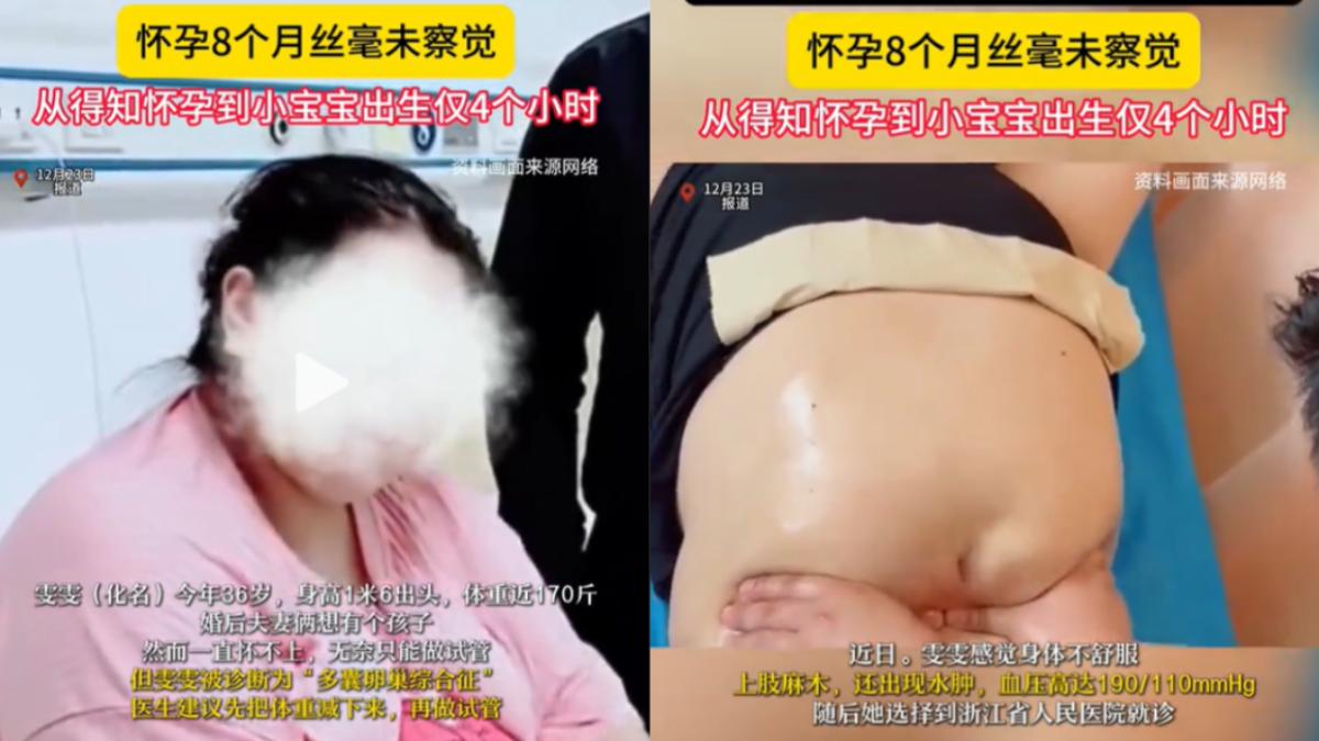 高血壓就醫陸女才知「懷孕8個月」 被告知後4小時產子