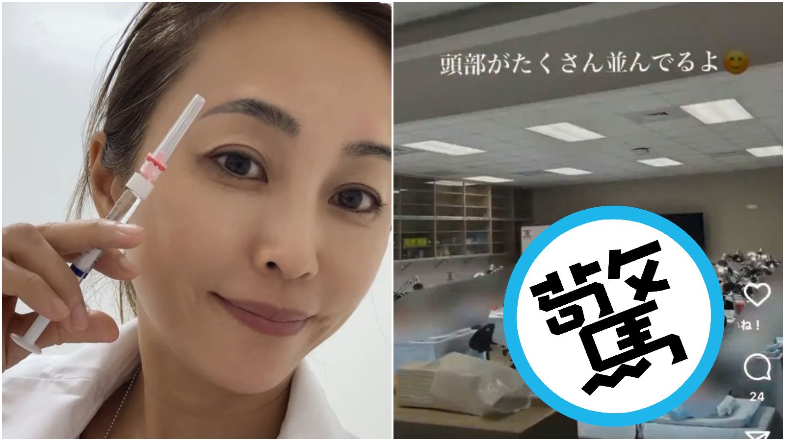 白目女院長po大體老師解剖照 2顆頭「無碼露出」日網炎上