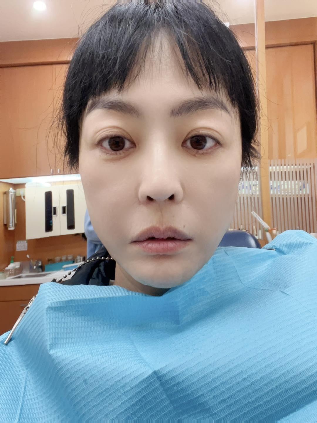 唐玲牙齒裂開，細菌入侵身體裡面。（圖／翻攝自唐玲臉書）